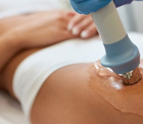 BTL X-Wave® - fala uderzeniowa: ujędrnianie oraz redukcja cellulitu i rozstępów