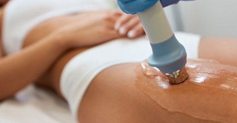 BTL X-Wave® - fala uderzeniowa: ujędrnianie oraz redukcja cellulitu i rozstępów